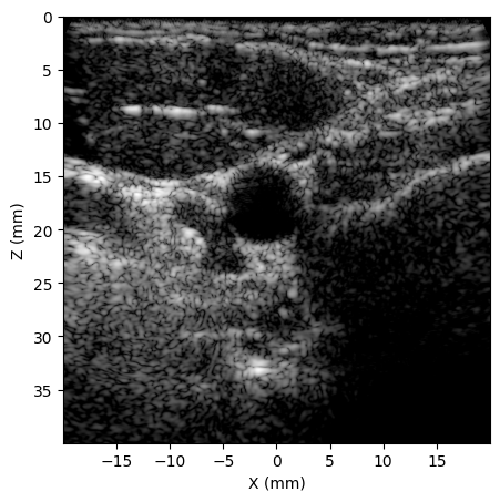 B-mode carotid image