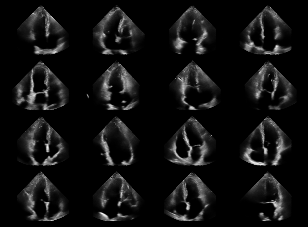 ../../_images/notebooks_models_diffusion_model_example_14_0.png